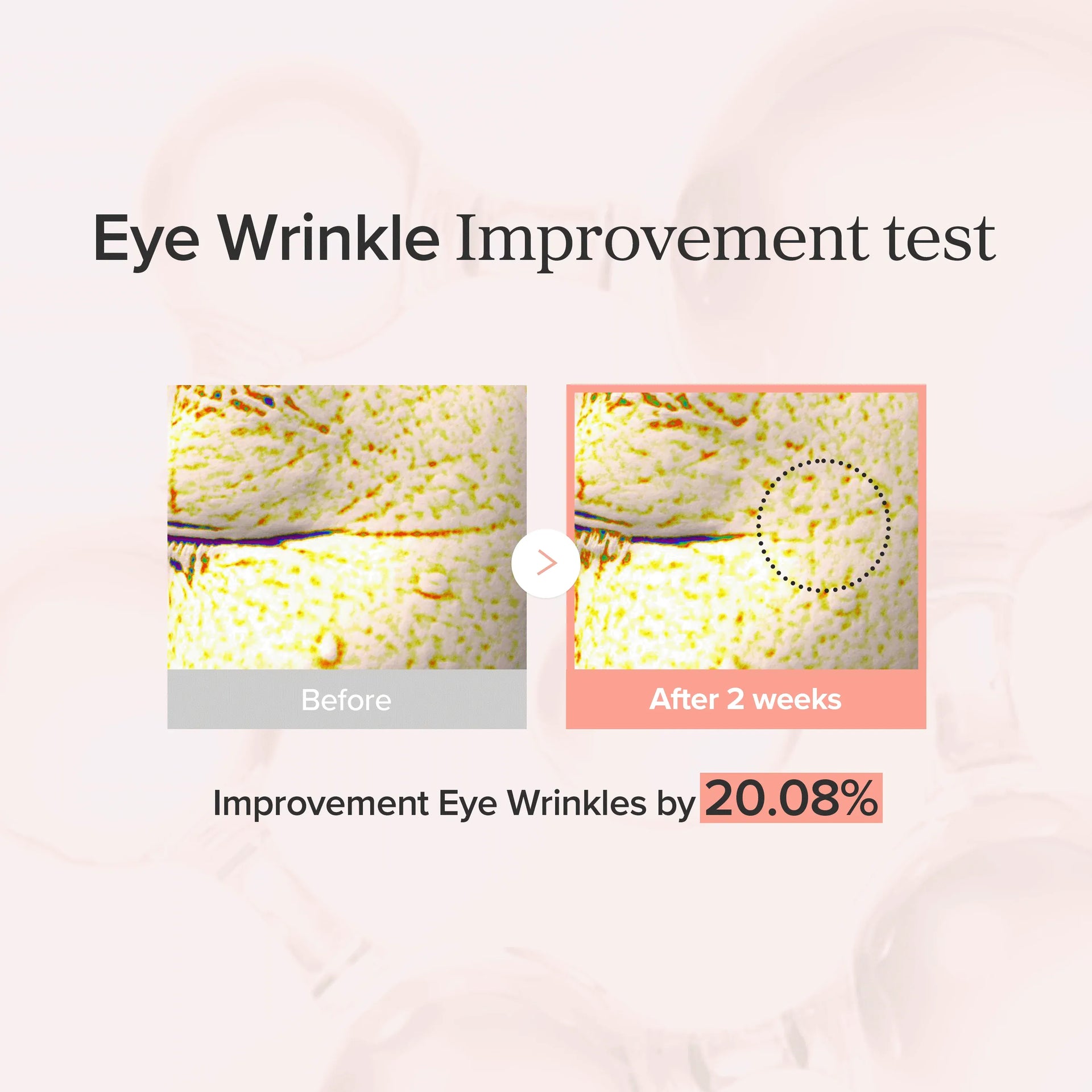 Beauty of Joseon Retinal Eye Cream result – firmer brighter under eye