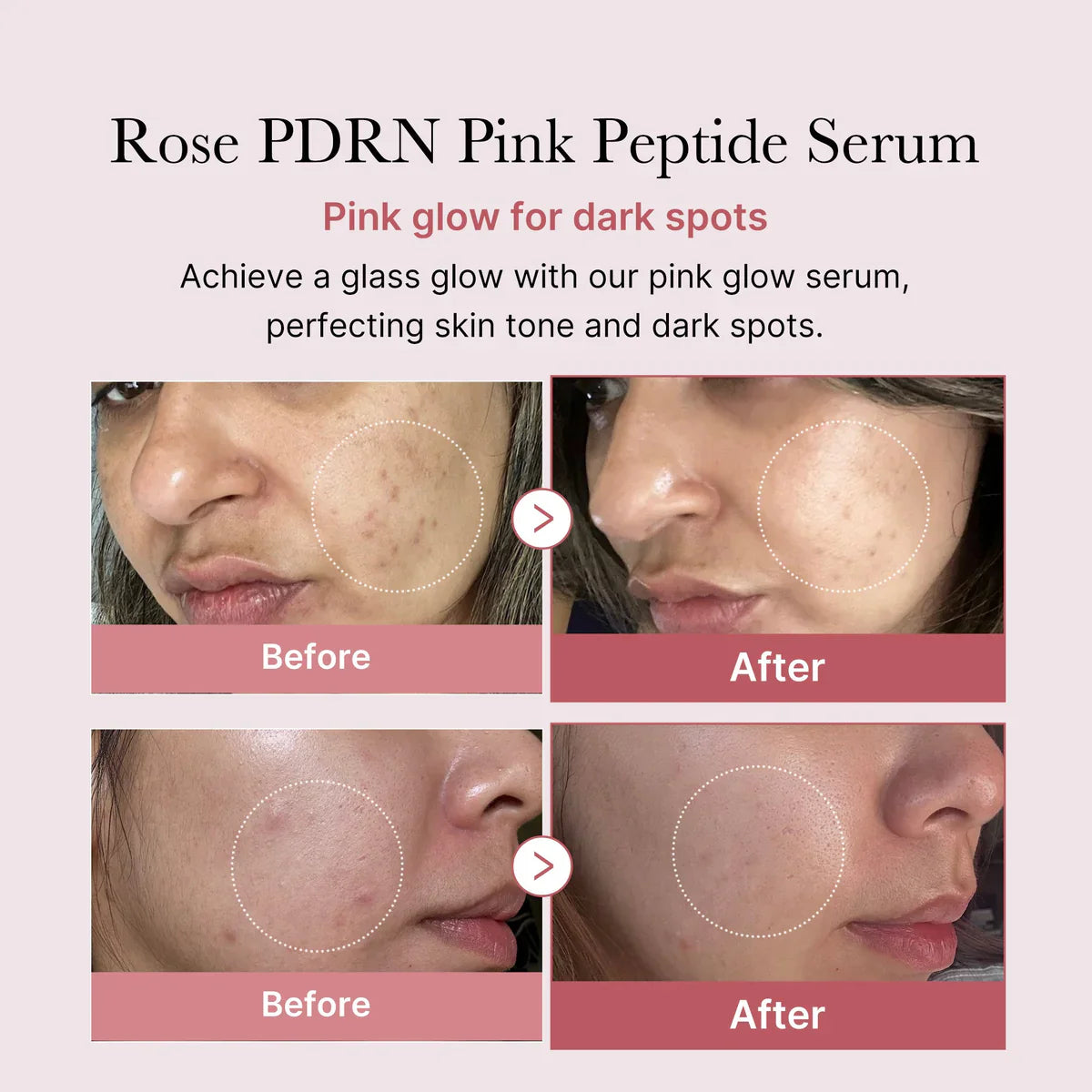 Medicube PDRN Serum